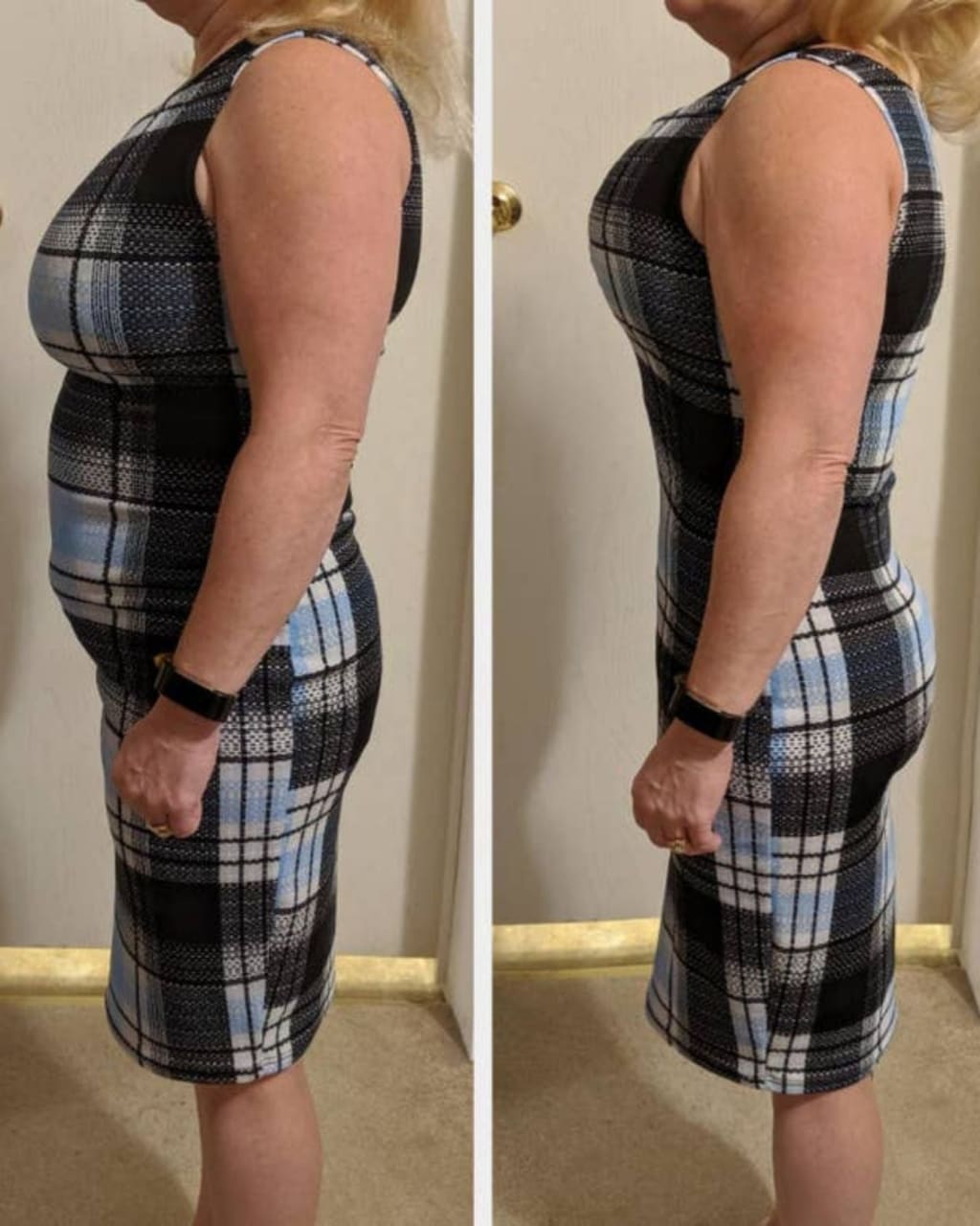 Softiana Toparlayıcı - Vücudunun En İyi Halini Keşfet